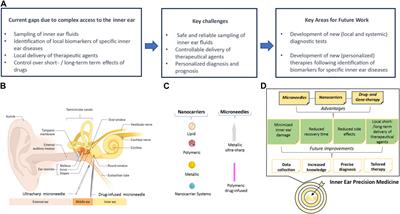 Frontiers Precision Medicine A New Era For Inner Ear Diseases